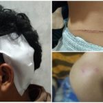 Lima Pelajar Diserang Sekelompok Orang di Kelurahan Talang Benih, Satu Korban Alami Luka Serius